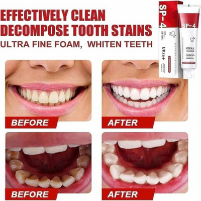 SP-4 Whitening Toothpaste for All egoodpk