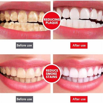 SP-4 Whitening Toothpaste for All egoodpk