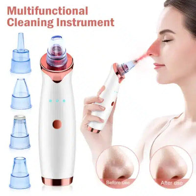 Vacuum Blackhead Remover & Pimple Spot Cleaner eGood