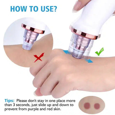 Vacuum Blackhead Remover & Pimple Spot Cleaner eGood